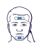 Le système Jawac pour le dépistage des troubles du sommeil